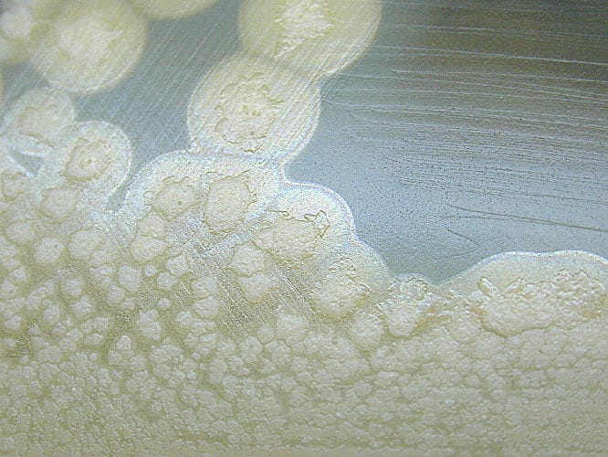 Botulism in Food